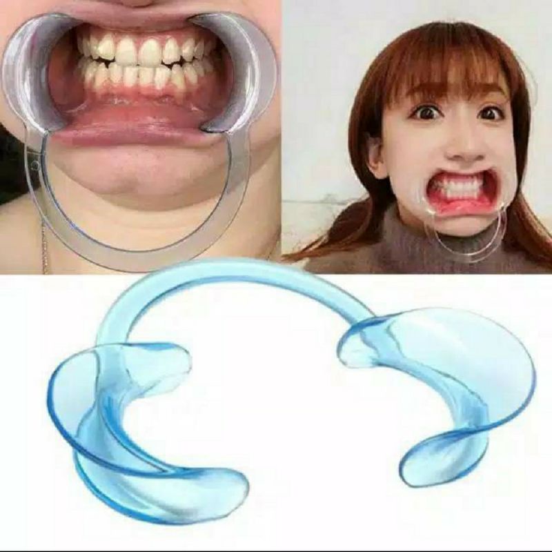 Alat Pembuka Mulut Praktek Dokter Gigi