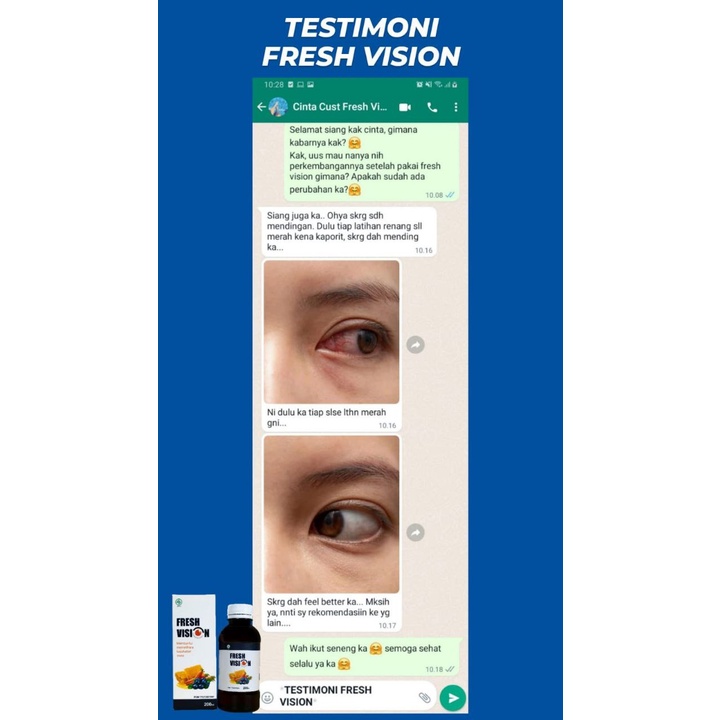 FRESH VISION Obat Mata Herbal / Suplemen Mata Madu FRESH VISION Untuk Mata Merah Lelah Kering Iritasi Gatal Buram Mata Minus / Nutrisi Mata Cegah Katarak Glaukoma 200ml
