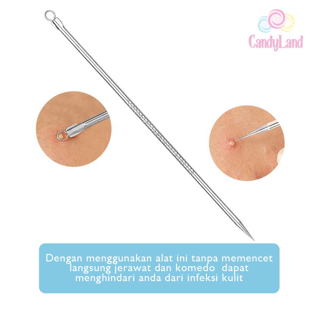 Set Alat Pencabut Komedo Pinset Pencetan Jerawat Pembersih Blackhead Stainless 3 Pcs