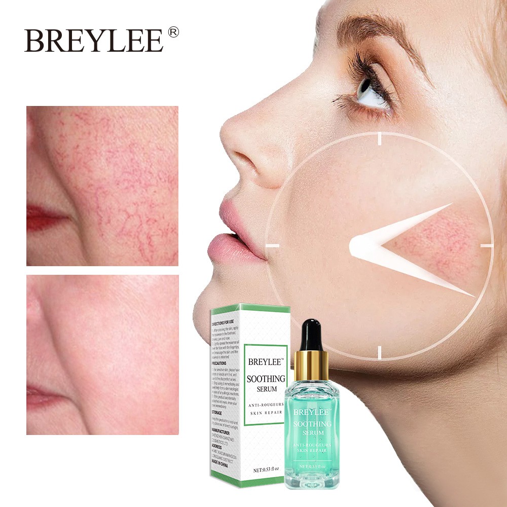 redness and sensitive skin