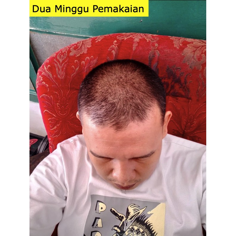 KELAYA HAIR TREATMENT SHAMPOO SOLUSI RAMBUT RONTOK & KEBOTAKAN 250ML-7