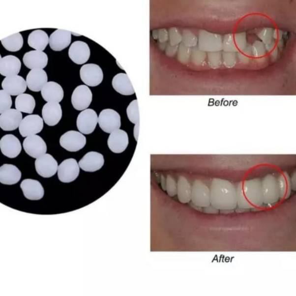 Temptooth/Lem Gigi/Lem Gigi Palsu/Gigi Palsu
