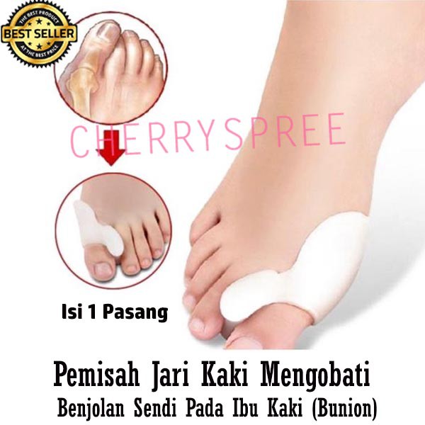 Silicon Gel Pemisah Jari Jempol Kaki Ibu Jari Mencegah Mengobati Pembengkakan Sendi Benjol Jempol