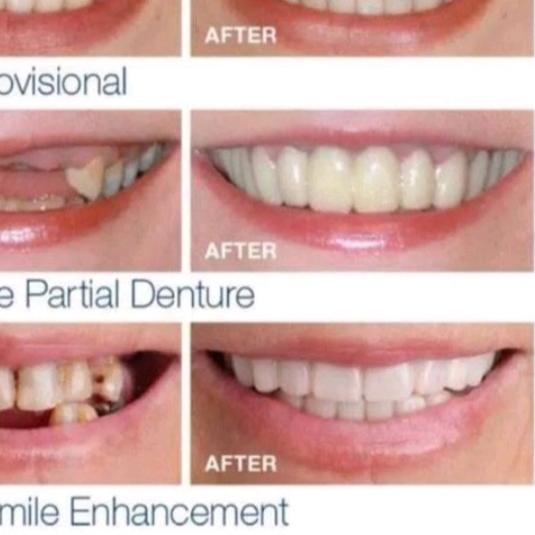 ♖ [BISA ] SNAP ON SMILE ORIGINAL ◌