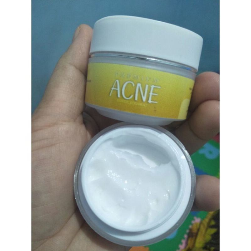 CREAM PREMIUM ACNE TOTOL WASILA COSMETIC