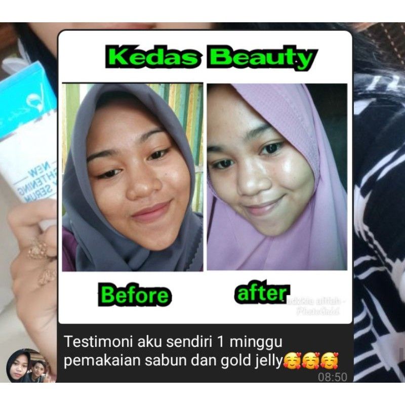 SABUN KEDAS BEAUTY BRIGHTENING SOAP ORIGINAL 100%-8