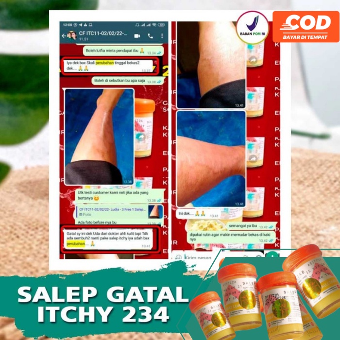 Salep Itchy 234 100% Original BPOM