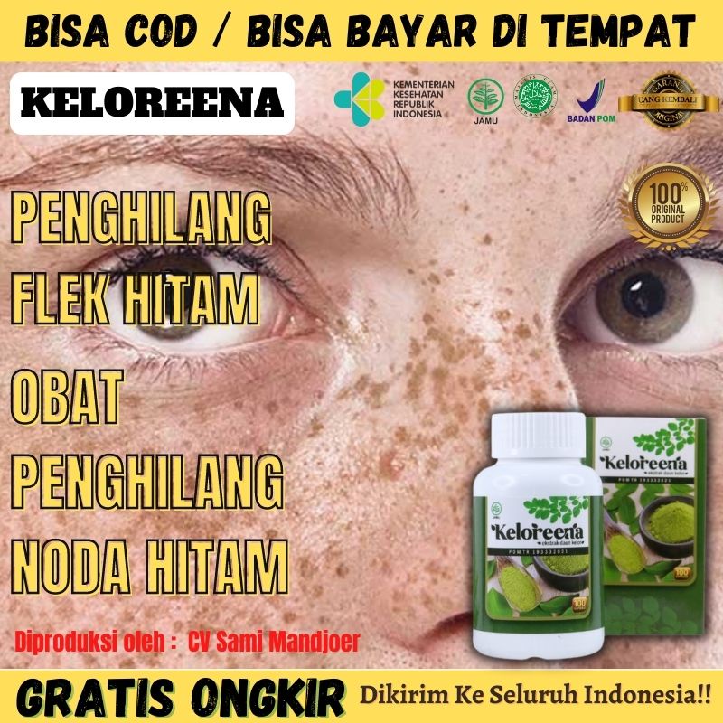 Keloreena - Obat Penghilang Flek Hitam di Wajah - di Pipi - Flek di Hidung - Hilangkan Flek yang Sud