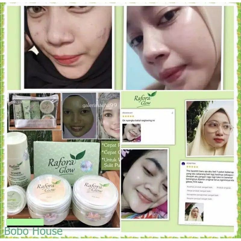 RF Super green glow ( PAKET KELUPAS ) Cream wajah / Pemutih
