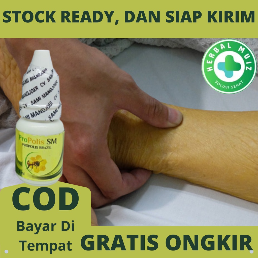 Obat Herbal Liver Hepatitis A, B, C Hati, Penyakit Kuning | Propolis Sm