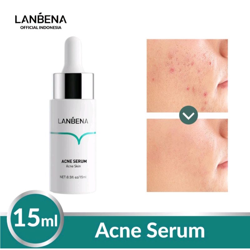 LANBENA ACNE SERUM