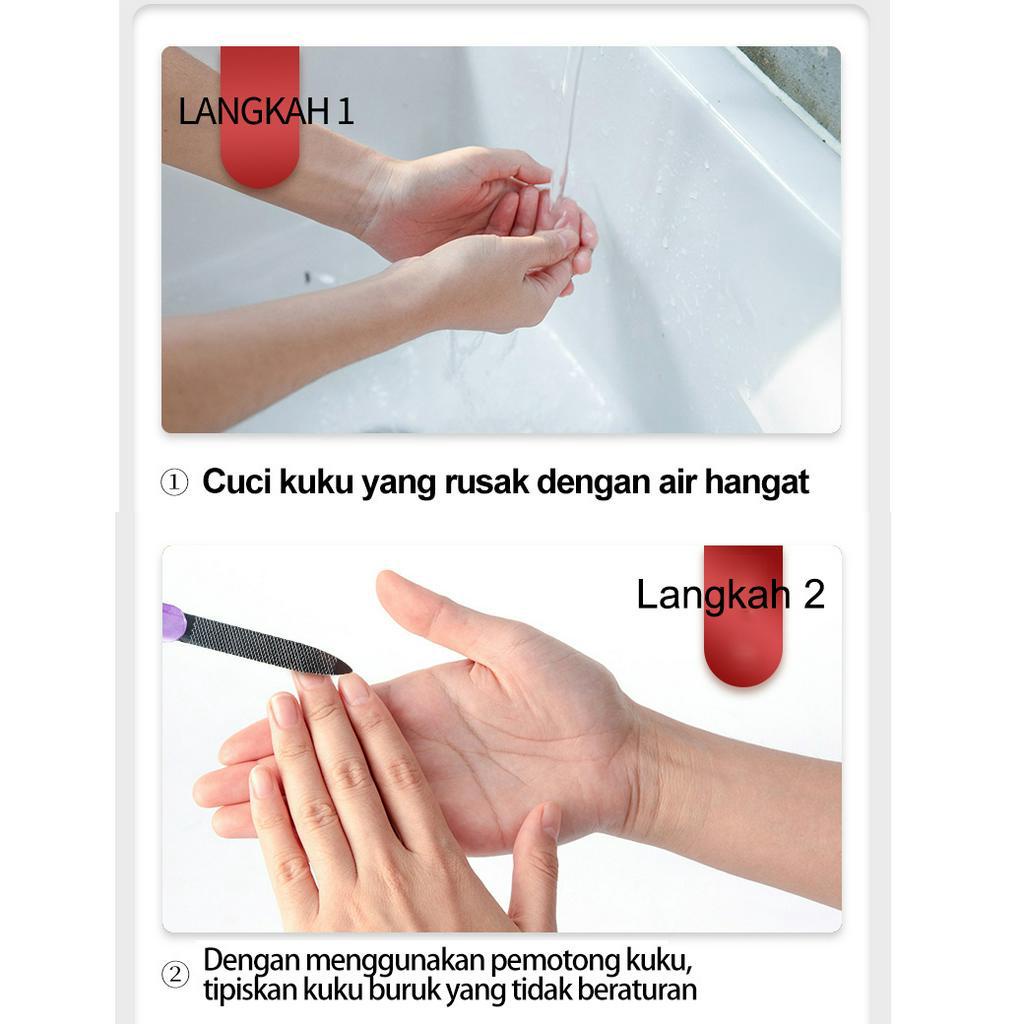 Jahe Antibakteri Perawatan Kuku Onikomikosis Paronychia Anti Infeksi Kuku Toe Nail Pengobatan Jamur Minyak Esensial Ginger Antibacterial Nail Essential Oil