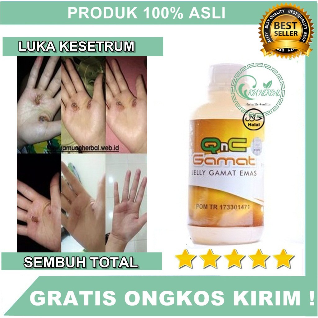 Obat Luka Kesetrum/Obat Luka Akibat Kesetrum/Obat Bekas Kesetrum/Obat Luka Bakar Kesetrum - QnC