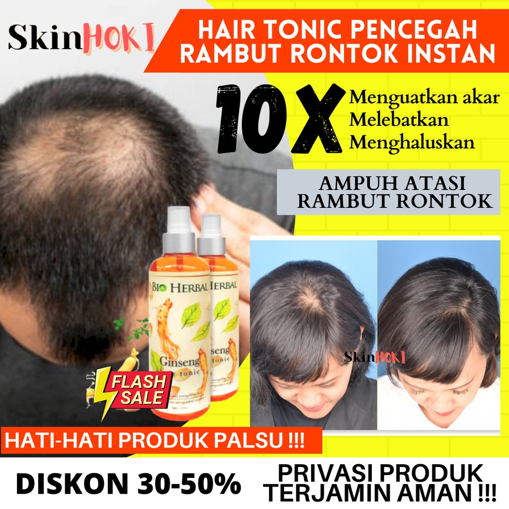 PAKET 2IN1 BIO HERBAL GINSENG PENUMBUH RAMBUT KEBOTAKAN PEMANJANG RAMBUT BIO HERBAL GINSENG &amp; HAIRTONIC BPOM ORIGINAL