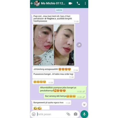Cream REGLOW Untuk menghilangkan Flek Jerawat Kerutan-6
