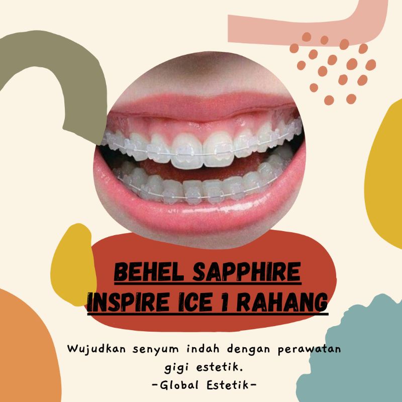 Behel Sapphire Inspire Ice 1 Rahang Shopee Indonesia