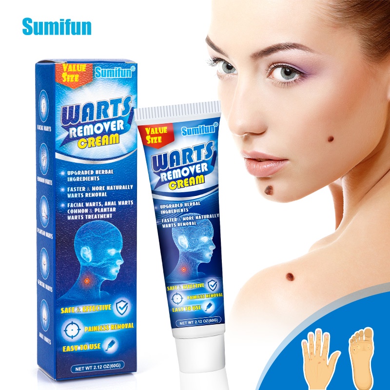 Sumifun Wart Remover Cream Skin Tag Remover Ointment 60gr - Menghilangkan Kutil Tahi Lalat Mata Ikan