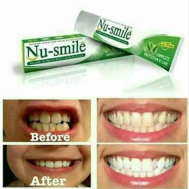 Nu smile