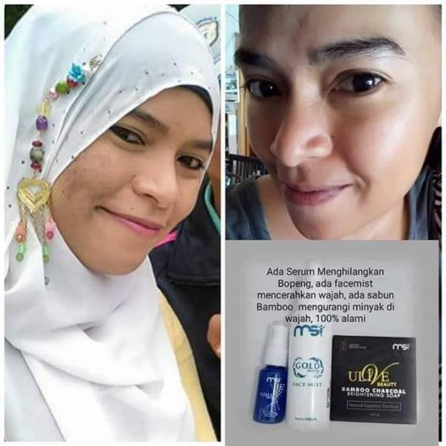 Skincare msi 3 serangkai