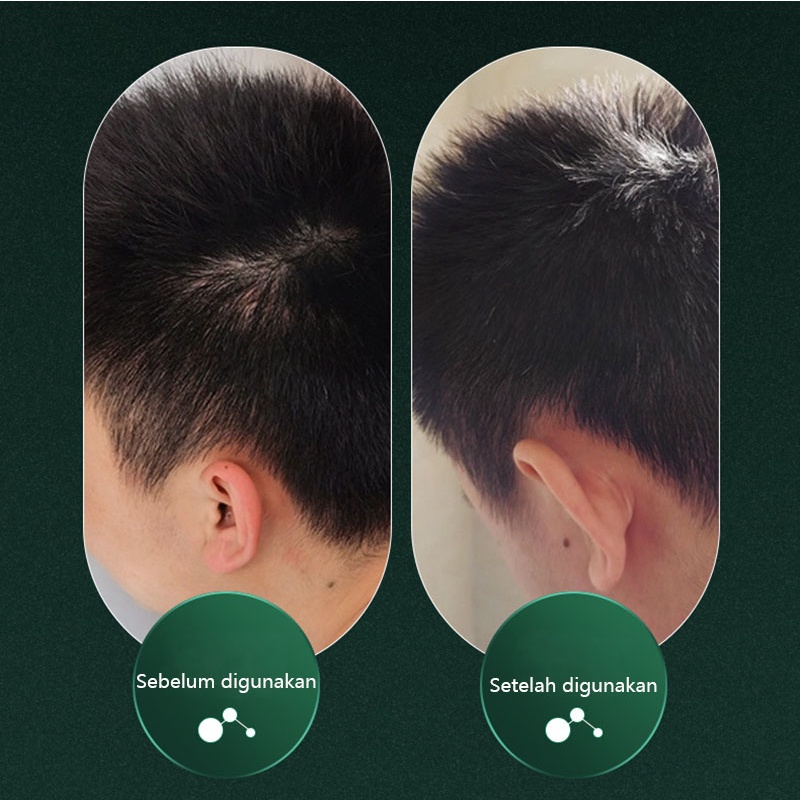 sampo pemanjang rambut sampo kutu sampo rambut 200g ekstrak herbal untuk membersihkan kulit kepala secara mendalam dan mengatasi masalah rambut berminyak dari akarnya