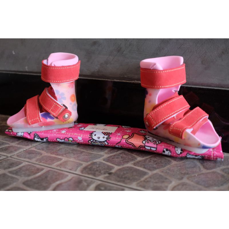 Dennis Brown CTEV/ Kaki Pengkor Bayi