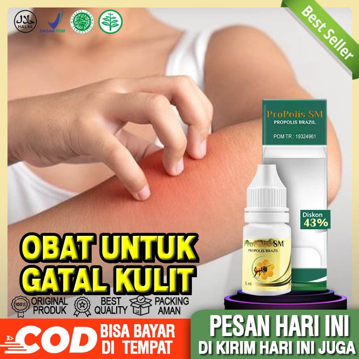 Obat Gatal Kulit, Obat Gatal Kulit Kepala, Gatal Kulit Anak, Obat Gatal Kulit Herbal, Kulit Alergi
