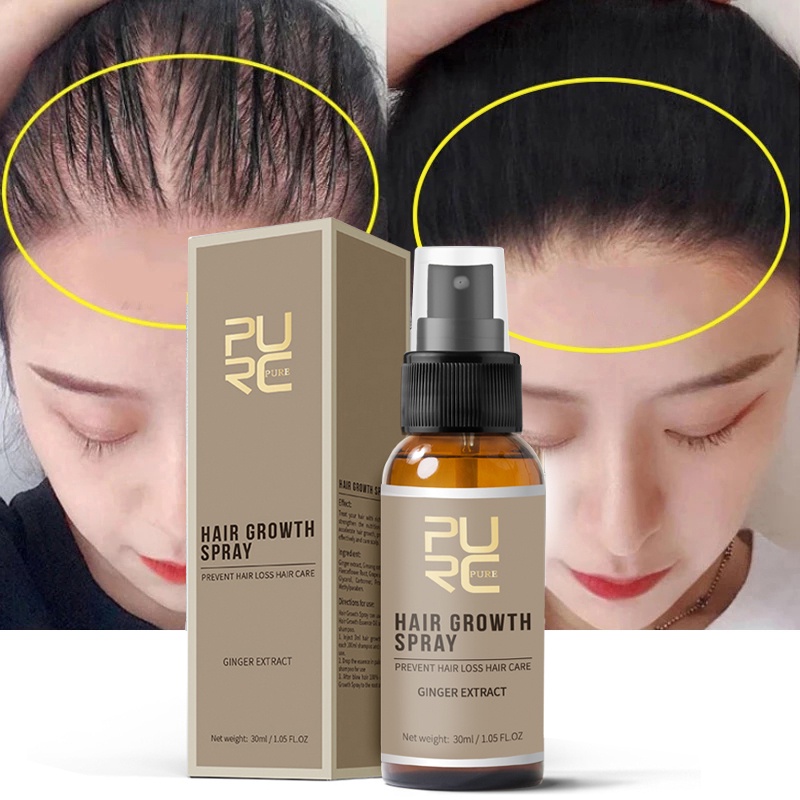 Produk Penumbuh Rambut Jahe Anti Rambut Rontok Serum Semprot Cepat Tumbuh Perawatan Minyak Esensial Rambut Kering Menipis Perawatan Kulit Kepala Keriting