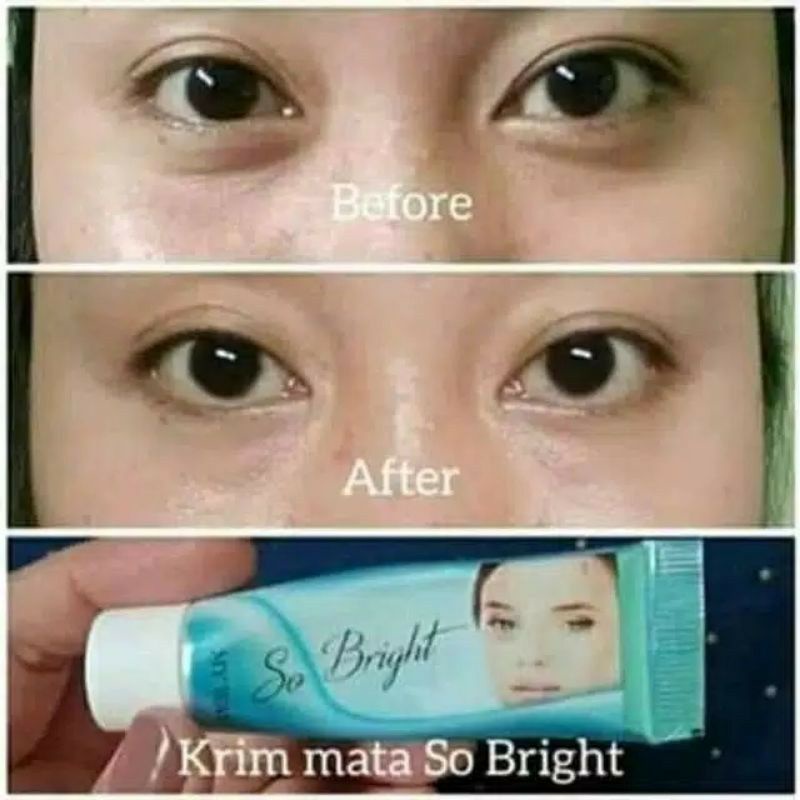 Cream mata panda lingkaran hitam / eye dark cream / Cream my way mata panda / So bright eye contour cream / Cream Kerutan Mata BPOM / Cream Mata Panda BPOM aman