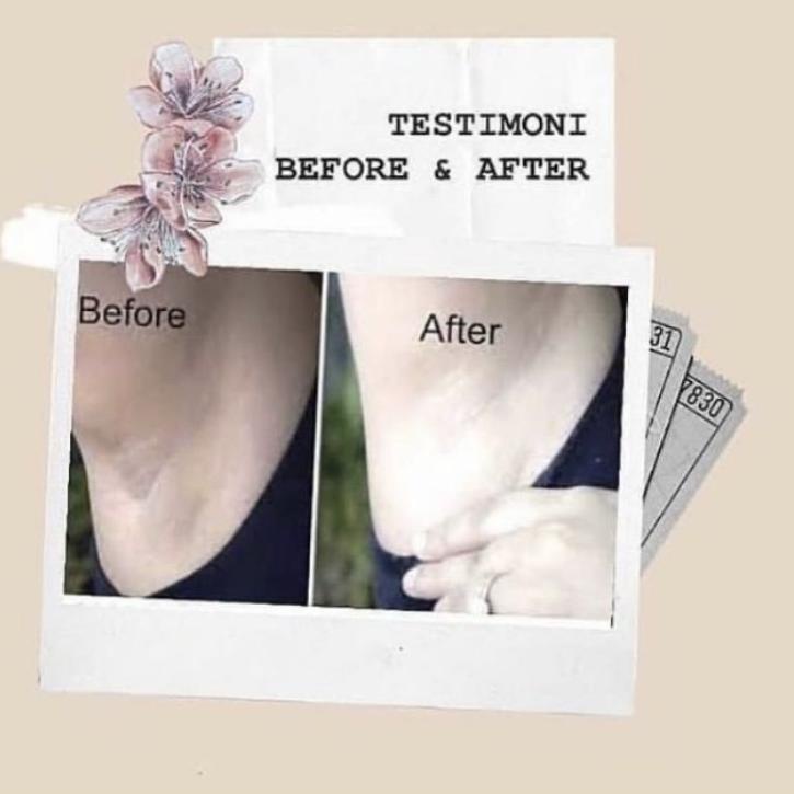 ⚡COD OXTERWHITE | PEMUTIH KETIAK ORIGINAL 100% | PEMUTIH SELANGKANGAN TERVIRAL #murah