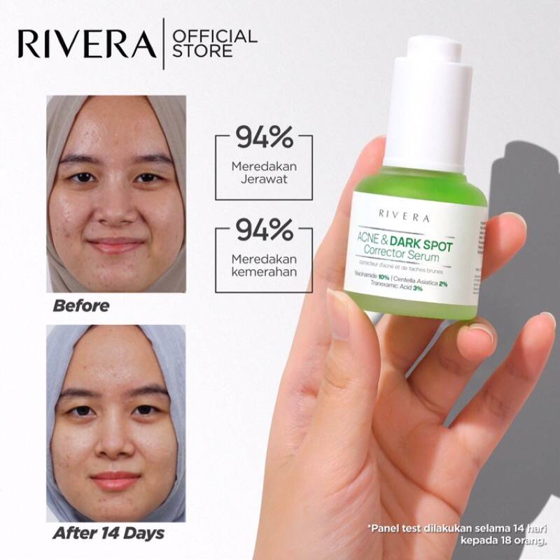 Rivera acne &amp; dark spot corrector serum