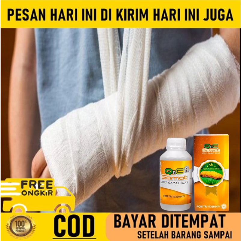 Obat Patah Tulang tangan - Obat Patah Tulang herbal - Obat patah tulang Gamat -  Obat Kesehatan Tula