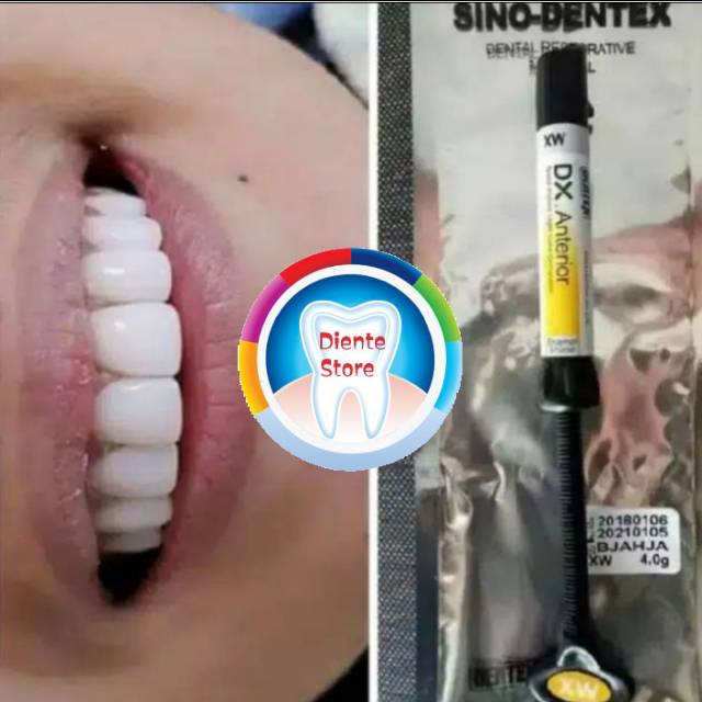 DENTEX EXW / KOMPOSIT DENTEX EXTRA WHITE / COMPOSITE VEENER DENTEX