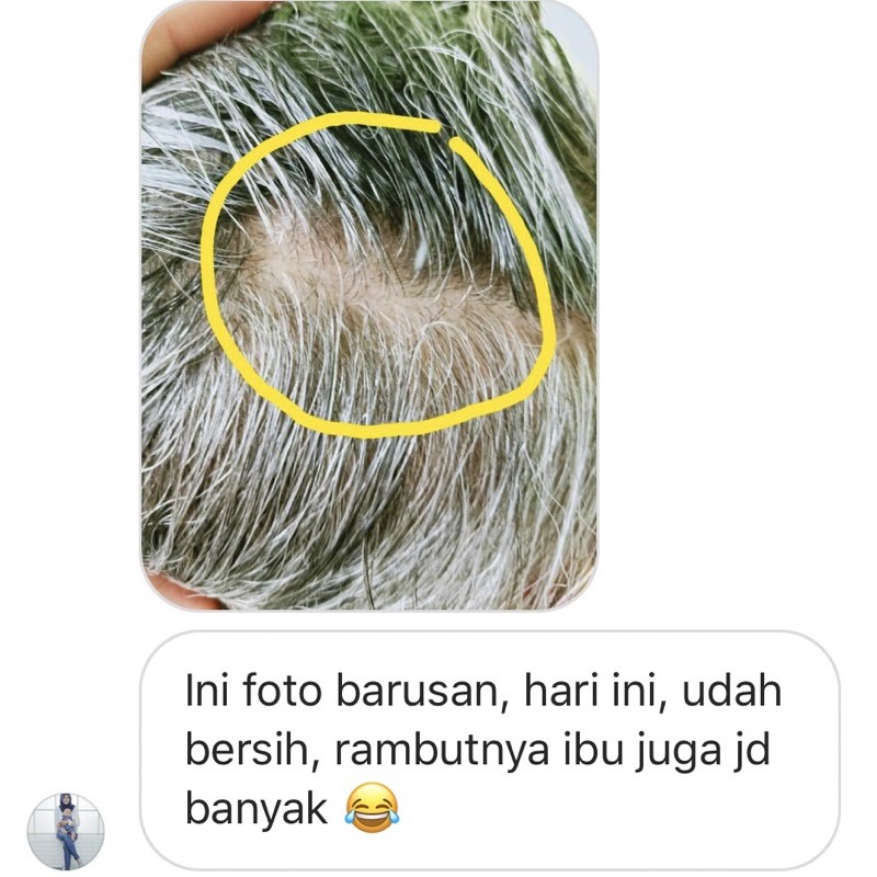 follow me green tea shampoo conditioner 100ml  |  followme greentea sampo manise rontok anti hairfall-5