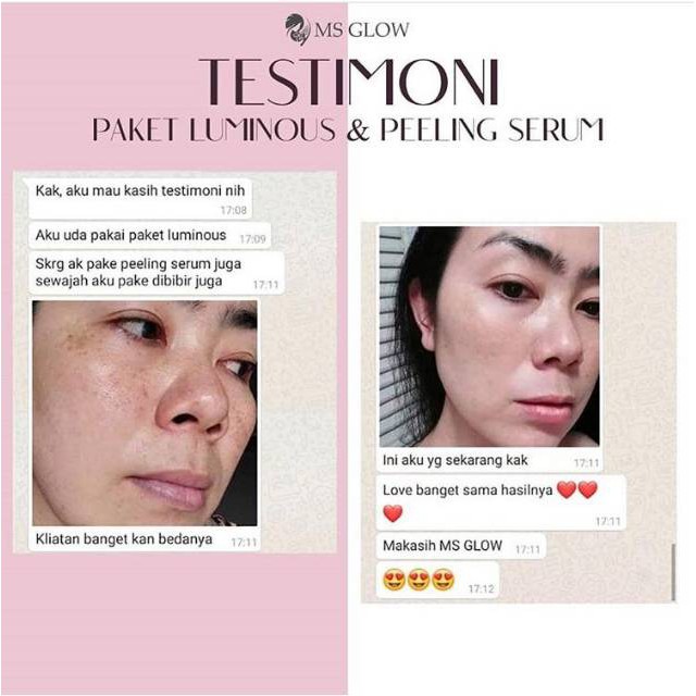 SERUM MS GLOW / SERUM LUMINOUS MS GLOW / SERUM LIFTHING MS GLOW / SERUM ACNE MS GLOW / SERUM GOLD