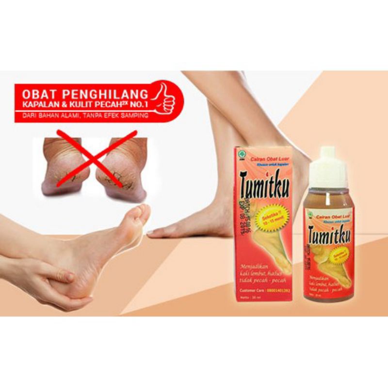 Tumitku Obat Herbal Tumit Pecah dan Kapalan BPOM Original Asli