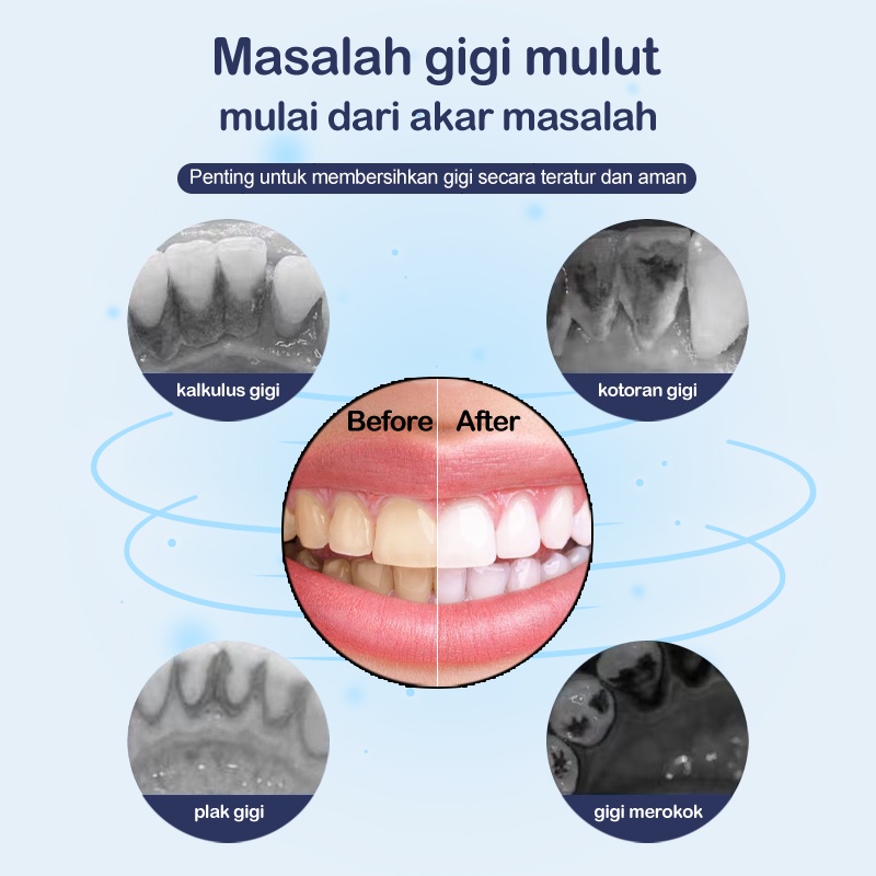 Alat Pembersih Karang Gigi Dental Scaling Sonic Elektrik 1 Set 3 Modes Perawatan Dan Pembersih Karang Gigi Dental Remover With Light