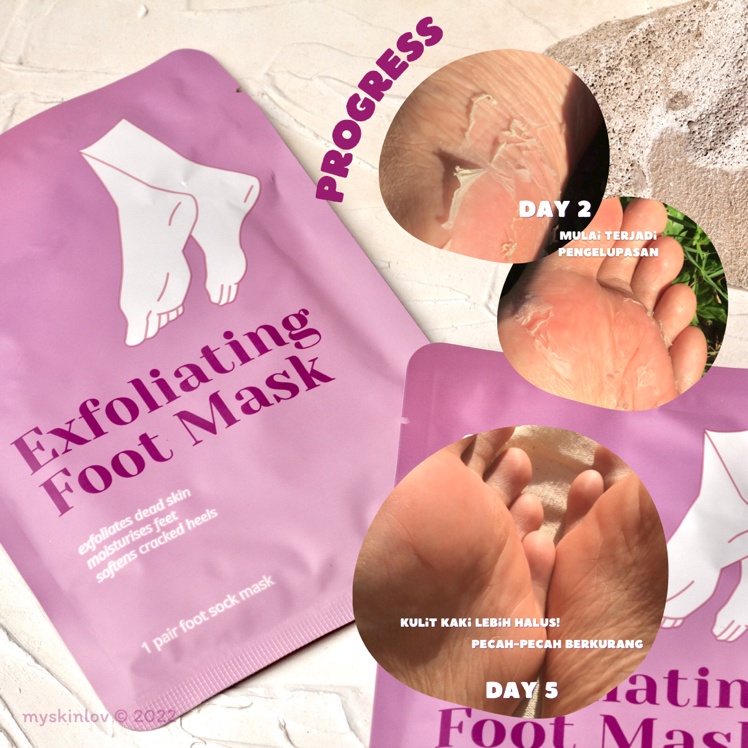 RADYSA - Noera Exfoliating Foot Mask