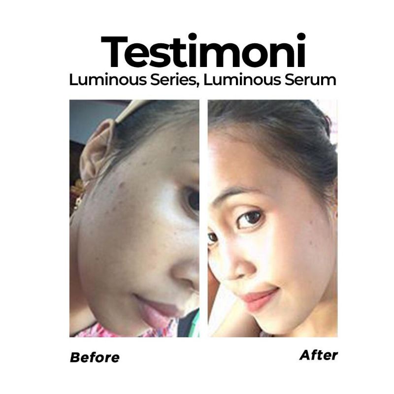 MS Glow Paket Wajah Luminous Series / Perawatan Wajah Bekas Noda Jerawat Ms Glow-7