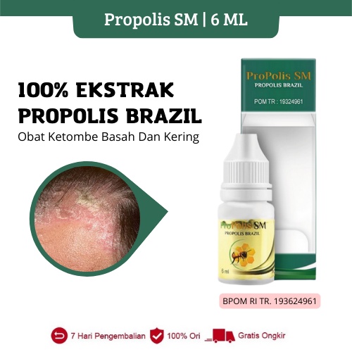 Propolis SM - Obat Ketombe Berkerak Basah / Kering, Borok Kepala, Rambut Rontok - Aman Untuk Anak An