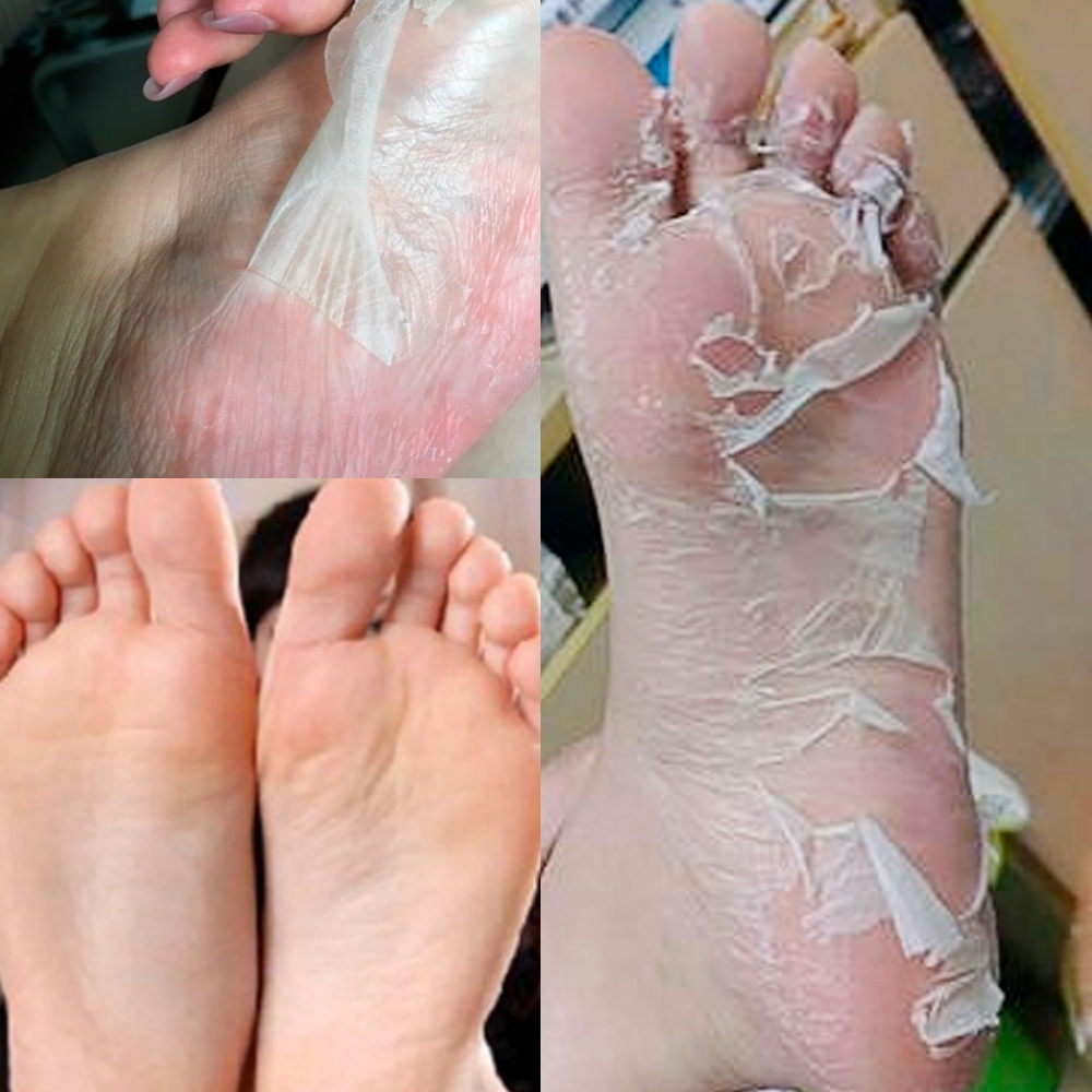 NEW LANBENA FOOT PEELING MASK | FELINZ FOOT MASK EXFLOATING 2 SHEETS - MASKER KAKI DEAD SKIN PEALING BPOM