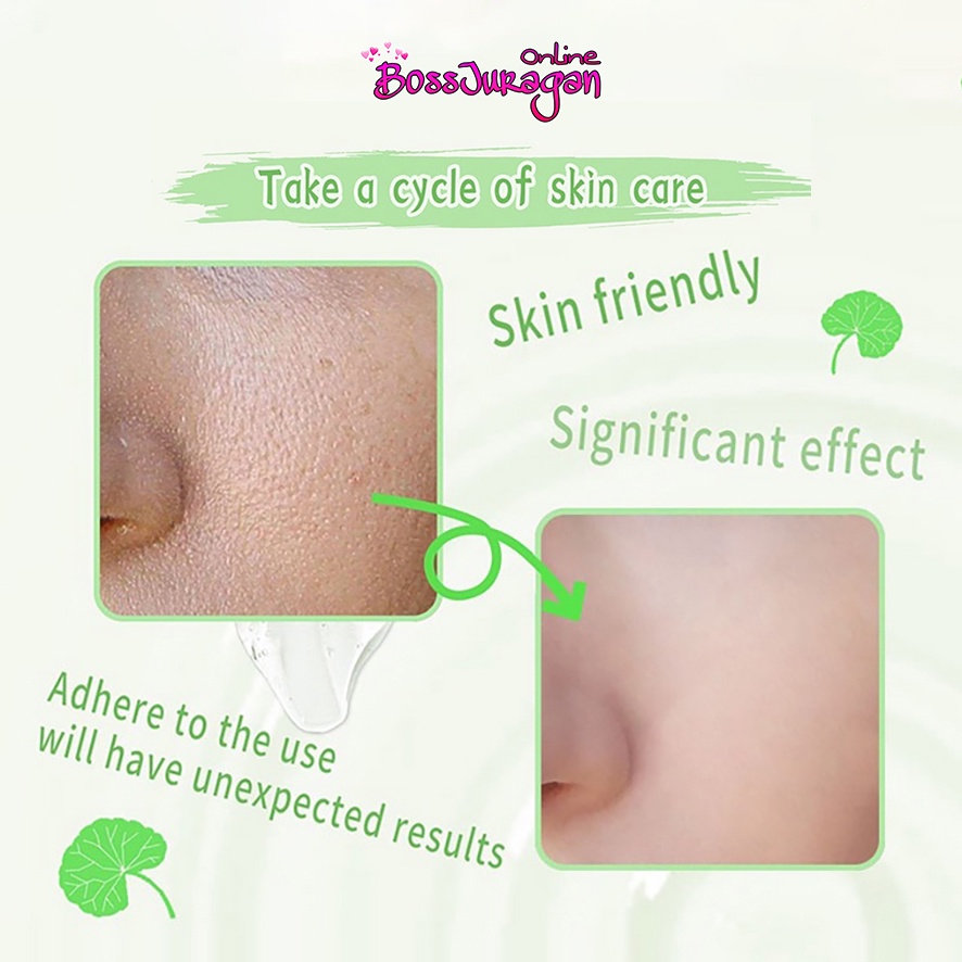 (BOSS) (CUCI GUDANG) [BPOM] GIRLPAL Centella Asiatica Peeling Gel - Aloe Vera Gel - CHARCOAL 100GR