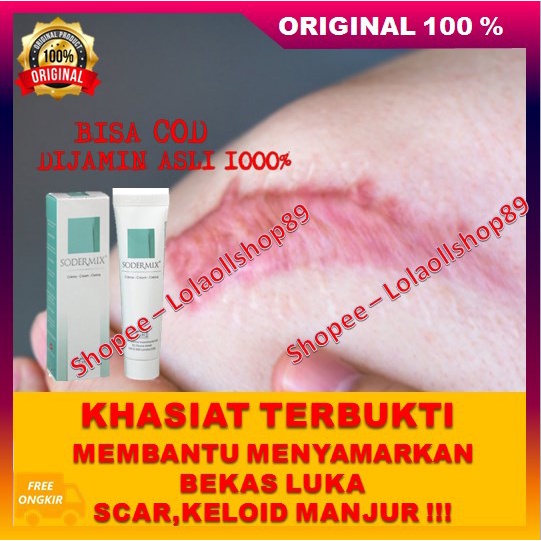Sodermix Cream Menyamarkan Bekas Luka Scar Keloid Ruam Popok Ampuh 100% ASLI ORIGINAL