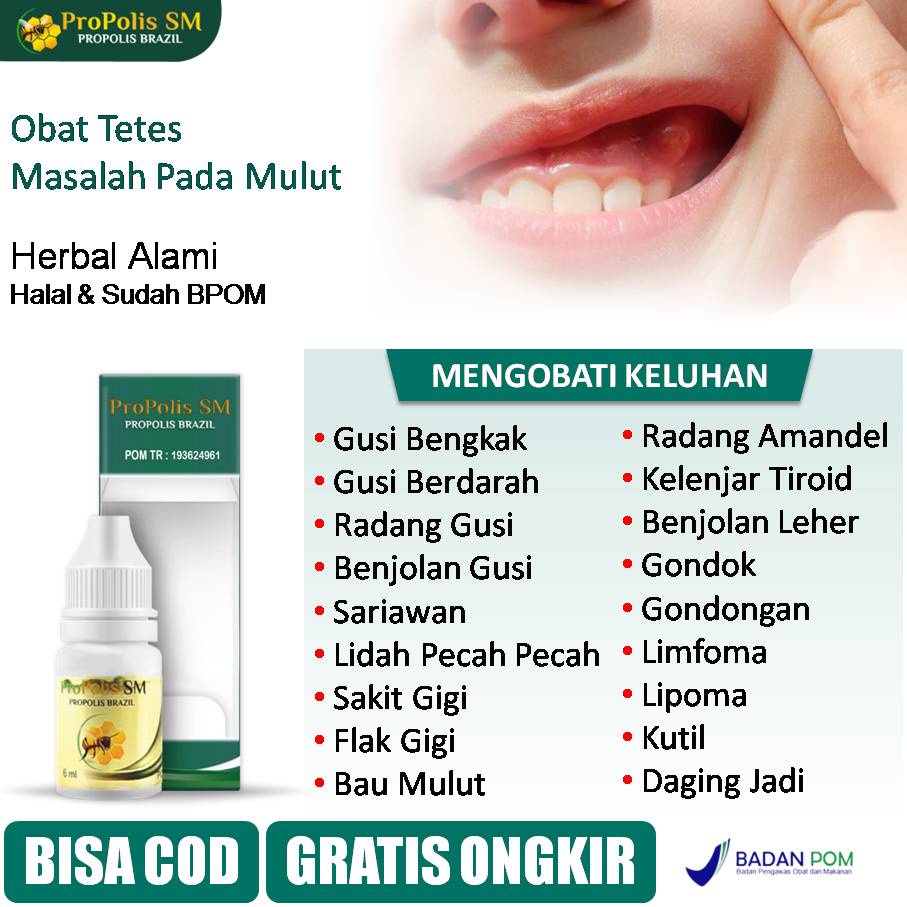 Jual Obat Gusi Bengkak, Gusi Berdarah, Benjolan Di Gusi, Sariawan