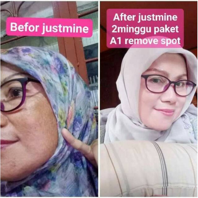cream justmine remove spot