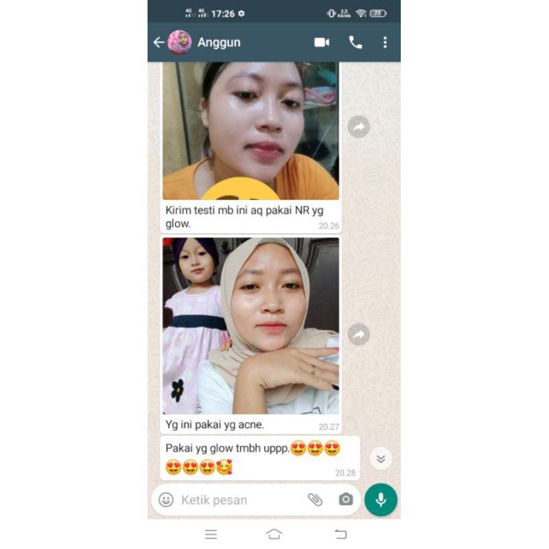 Nr Glow Paket Whitening Ultimate Terbukti Bikin Wajah Glowing - Rjnskin Glow Skincare Pemutih Wajah Cukup 1 Paket Wajah Sudah Glowing-4