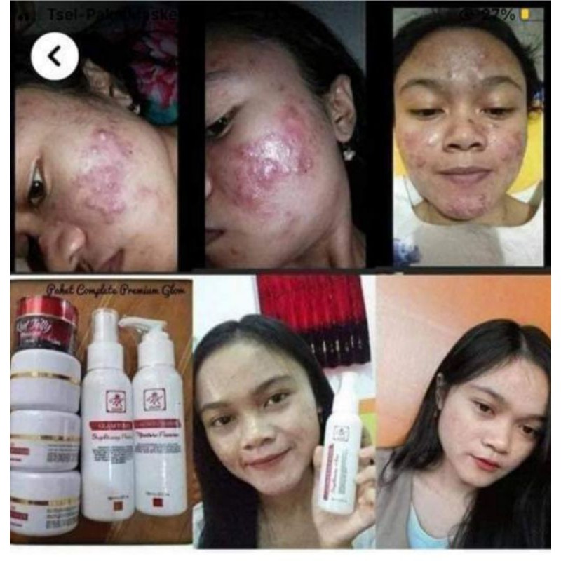 

rkglowacne