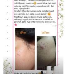 ☜ ADORALY skincare bpom Original ❂