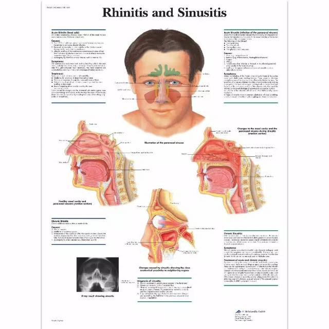 Alat Terapi Hidung Pilek Sinusitis Rhinitis Bionase