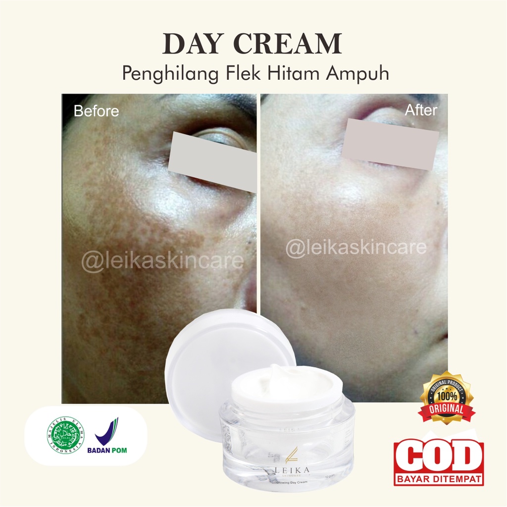 AMPUH Cream Penghilang Flek Hitam BPOM Aman Ampuh Perawatan Penghilang Bintik Hitam Di Wajah Krim Fl