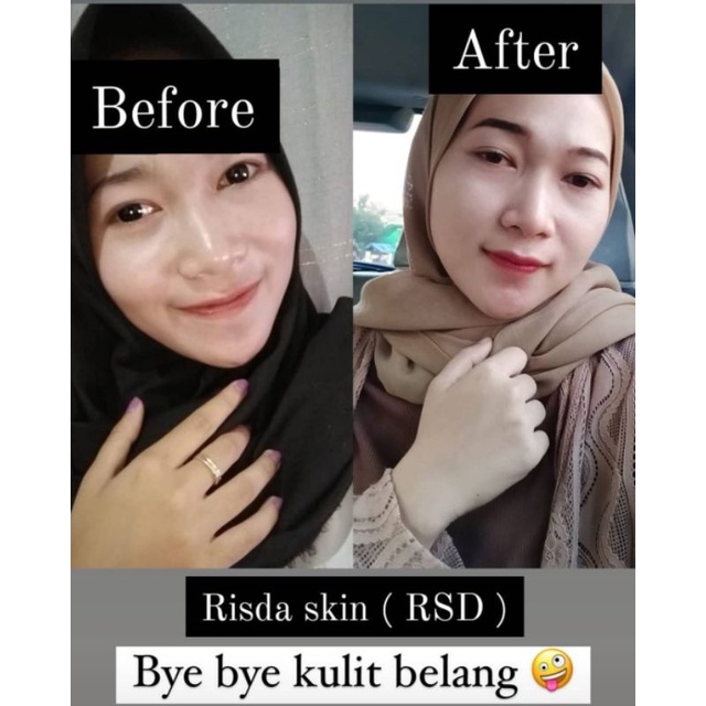 PAKET BADAN RSD EKONOMIS,RISDA SKIN GLOW